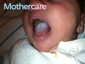 Las Mejores Ofertas de lengua blanca bebé leche para tu niño