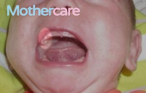 Los Mejores perla leche boca bebé para tu bebé